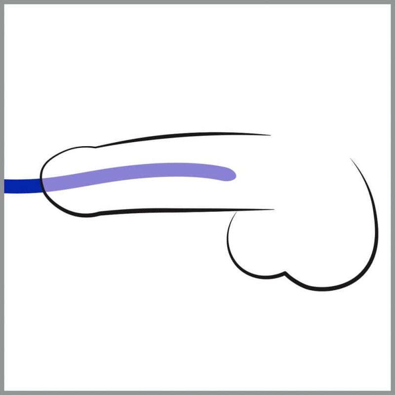You2Toys - DILATOR - szilikon dilátor szett (3db) 64570 termék bemutató kép