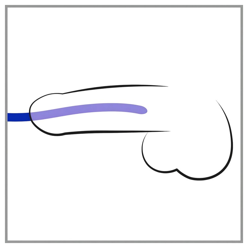You2Toys - DILATOR - szilikon dilátor szett (3db) 120235 termék bemutató kép
